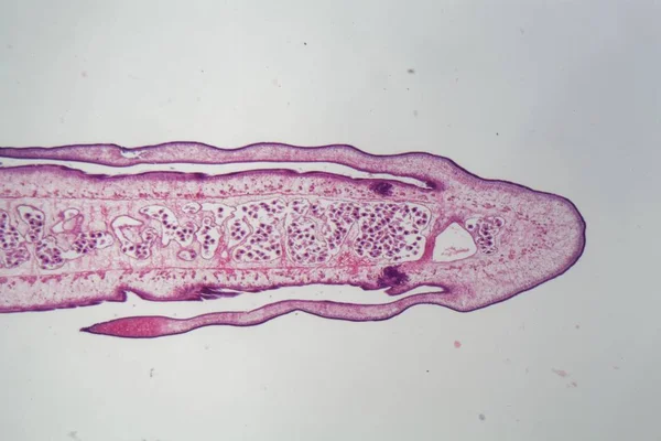Segmento de un cuerpo de lombriz solitaria (Proglotid ) — Foto de Stock