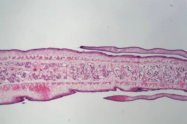 Segment eines Bandwurmkörpers (Proglottis)) — Stockfoto