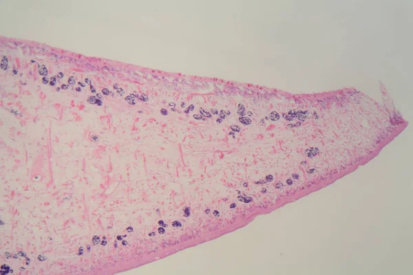 Section of a common liver fluke (Fasciola) under the microscope