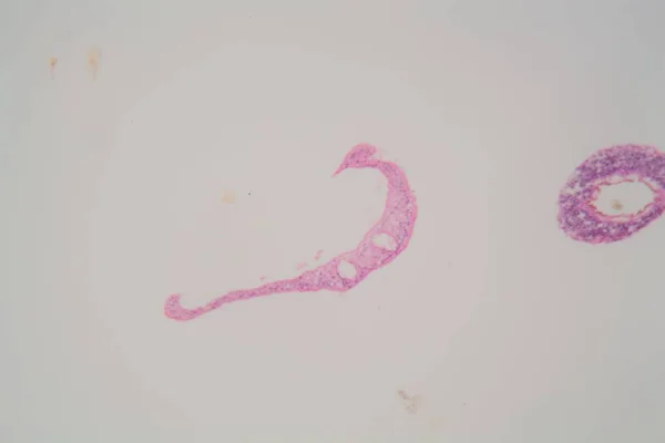 Parasitas de Schistosoma mansoni ao microscópio . — Fotografia de Stock