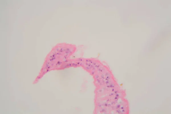 Parasitas de Schistosoma mansoni ao microscópio . — Fotografia de Stock