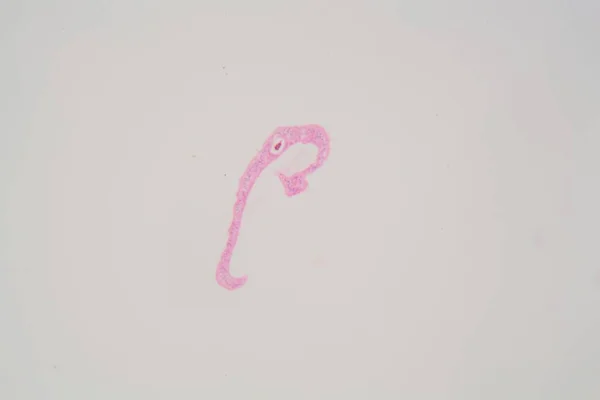 Schistosoma mansoni-Parasiten unter der Lupe. — Stockfoto