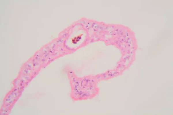 Parasitas de Schistosoma mansoni ao microscópio . — Fotografia de Stock