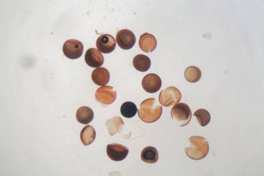 Mikroskop altında karides yumurta