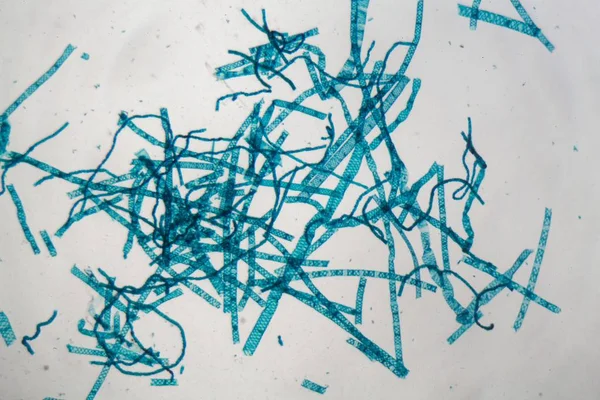 Mikroskop altında Spirogyra yosun — Stok fotoğraf