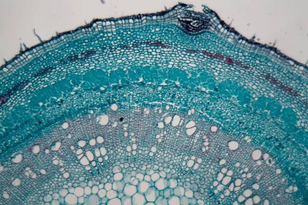 Stem cells of a lentil plant under the microscope.