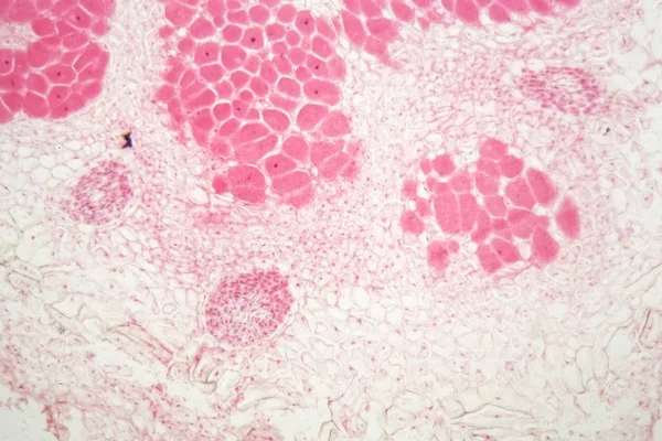 Rot bakterier noduler under mikroskopet. — Stockfoto