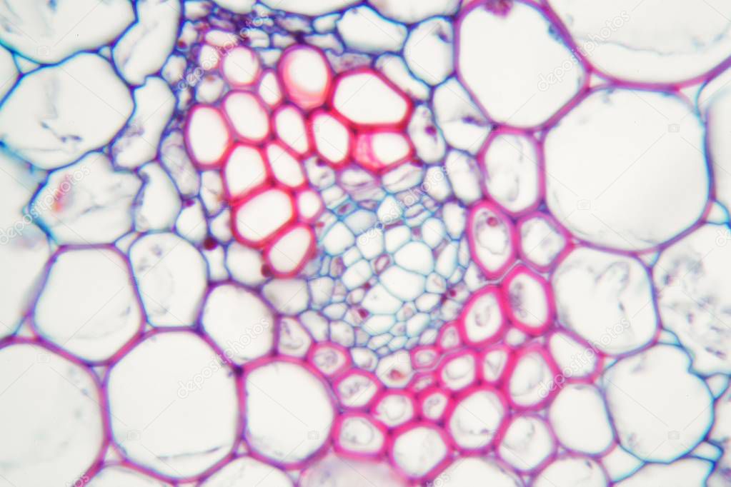 Cells of a Buttercup steam (Caltha palustris).