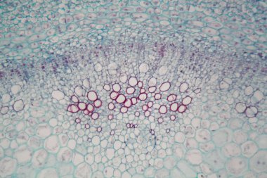 Mikroskop altında parankim hücreleri ile Sambucus kök