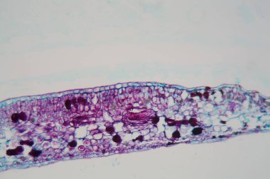 Mikroskop altında hasarlı epidermis ve kloroplastlı bir bitki yaprağının hücreleri