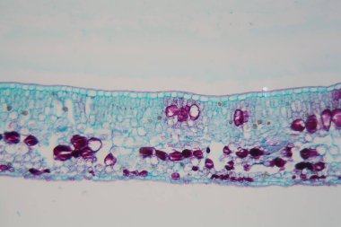 Mikroskop altında hasarlı epidermis ve kloroplastlı bir bitki yaprağının hücreleri