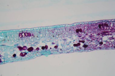 Mikroskop altında hasarlı epidermis ve kloroplastlı bir bitki yaprağının hücreleri