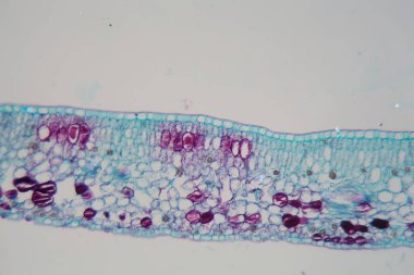 Mikroskop altında hasarlı epidermis ve kloroplastlı bir bitki yaprağının hücreleri