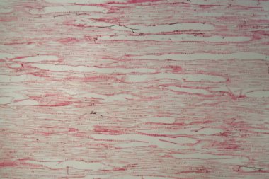 Mantar tarafından mikroskop altında tahrip edilen odun hücreleri