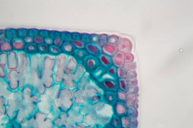 Kozalaklı iğne mikroskop altında çevresel hasarlarla.