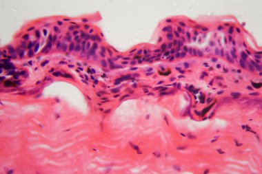 Mikroskop altında ülseri olan amfibi derisi