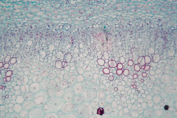 Sambucus stonek s buňkami v závorce pod mikroskopem — Stock fotografie