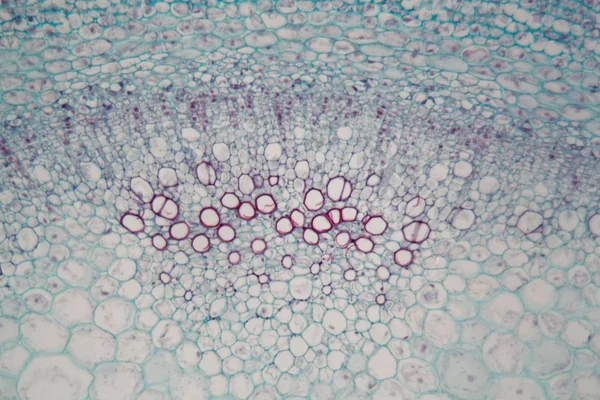 Tallo de sambucus con células parenquimatosas bajo el microscopio —  Fotos de Stock