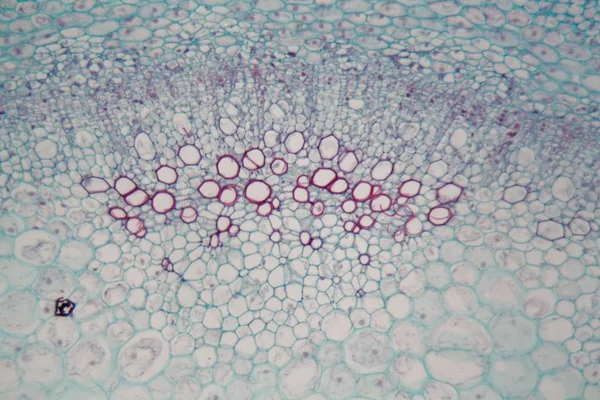 在显微镜下用帕伦奇马细胞的桑布库斯茎 — 图库照片