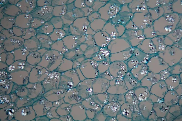 Komórki ziemniaczane z odciskkami skrobi pod mikroskopem — Zdjęcie stockowe