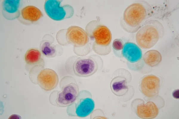 Grãos de pólen de diferentes espécies ao microscópio — Fotografia de Stock