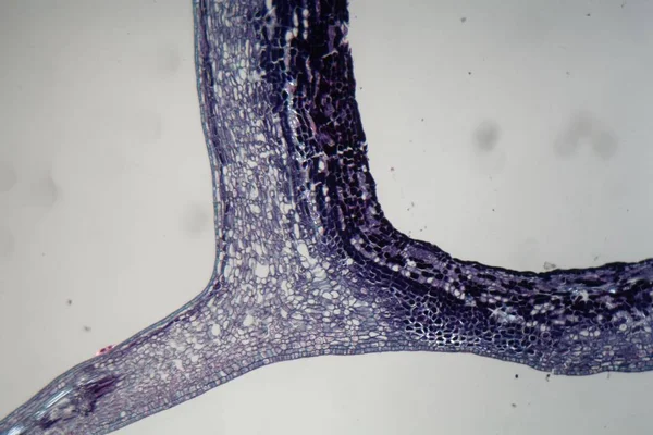 Növényi sejtek fertőzött növény parazita a Mikroszkóp alatt. — Stock Fotó