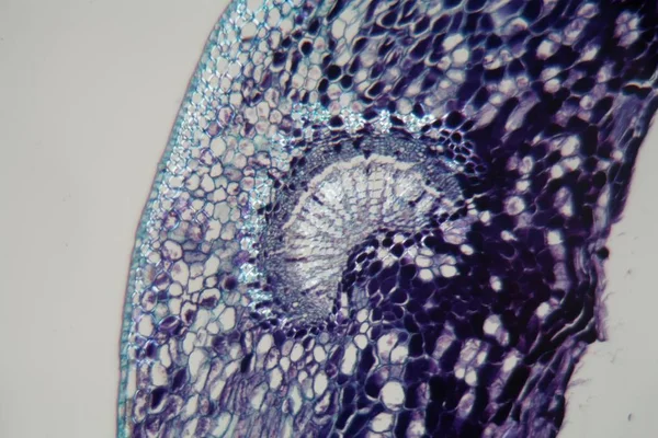 在显微镜下被植物寄生虫感染的植物细胞. — 图库照片