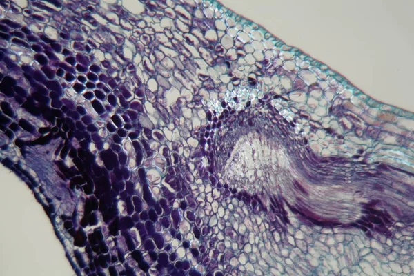 Pflanzenzellen, die von Pflanzenparasiten befallen sind, unter dem Mikroskop. — Stockfoto