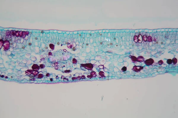 Mikroskop altında hasarlı epidermis ve kloroplastlı bir bitki yaprağının hücreleri — Stok fotoğraf