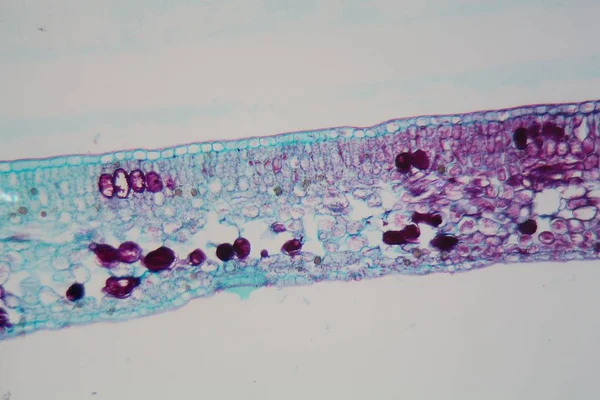 Las células de la hoja vegetal con la epidermis estropeada y los cloroplastos bajo el microscopio — Foto de Stock