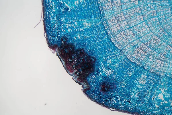 Cellules d'une tige végétale atteinte d'une maladie au microscope — Photo