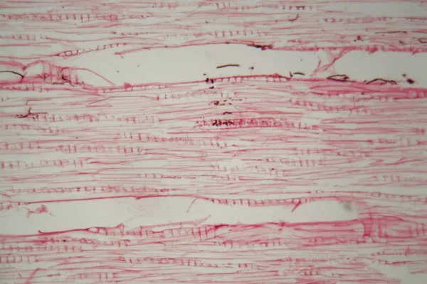 Ξύλινα κύτταρα καταστρέφονται από μύκητες κάτω από ένα μικροσκόπιο — Φωτογραφία Αρχείου