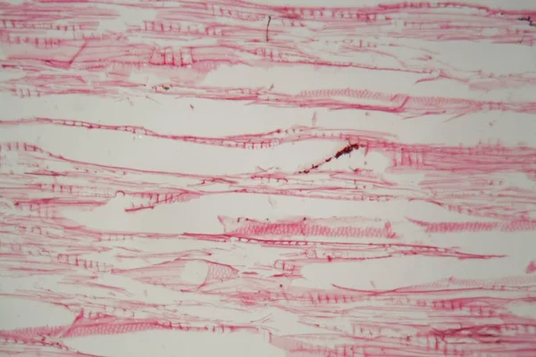 Деревянные клетки, уничтоженные грибками под микроскопом — стоковое фото