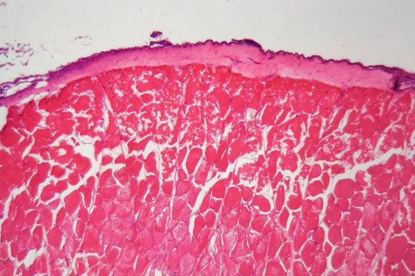 Pele de peixe ferida por produtos químicos ao microscópio . — Fotografia de Stock