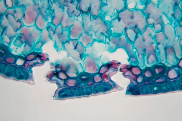 Aguja de coníferas con daños ambientales bajo un microscopio . — Foto de Stock