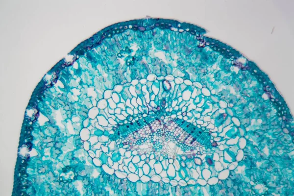 Nadelbaum-Nadel mit Umweltschäden unter dem Mikroskop. — Stockfoto