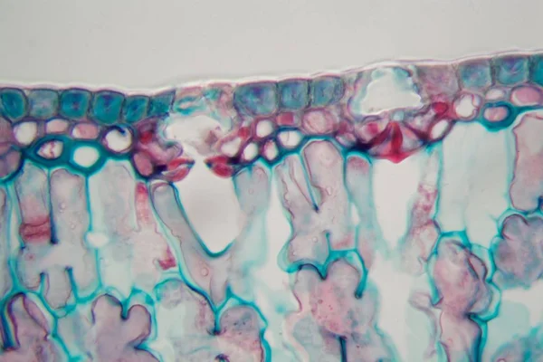 Aguja de coníferas con daños ambientales bajo un microscopio . — Foto de Stock
