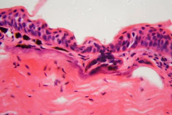 Amphibian skin with ulcer under a microscope