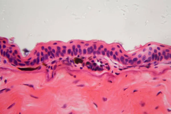 Piel de anfibio con úlcera bajo un microscopio — Foto de Stock