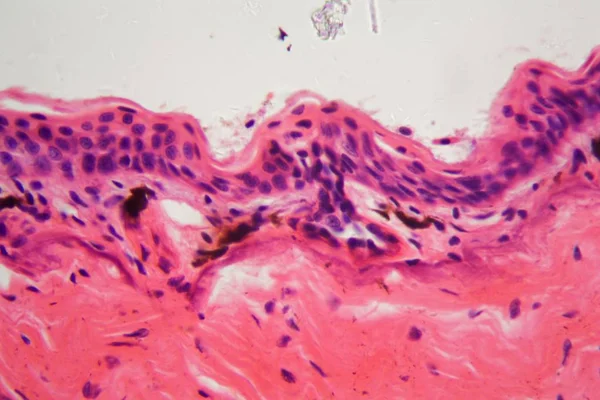 Piel de anfibio con úlcera bajo un microscopio — Foto de Stock