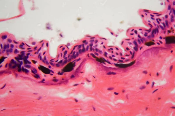 Amphibienhaut mit Geschwüren unter dem Mikroskop — Stockfoto