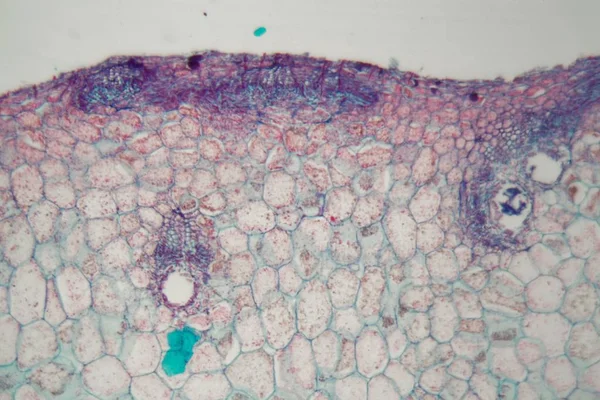 Växtceller med skador orsakade av ett parasitiskt djur under mikroskopet — Stockfoto