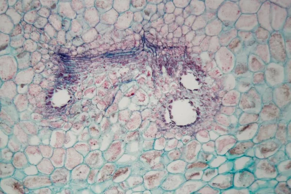 Células vegetales con daños causados por un animal parasitario bajo el microscopio — Foto de Stock