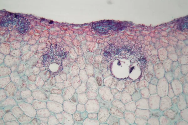 Växtceller med skador orsakade av ett parasitiskt djur under mikroskopet — Stockfoto