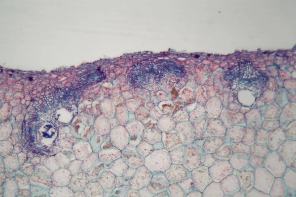 Komórki roślinne z uszkodzeniami spowodowanymi przez pasożytnicze zwierzę pod mikroskopem — Zdjęcie stockowe