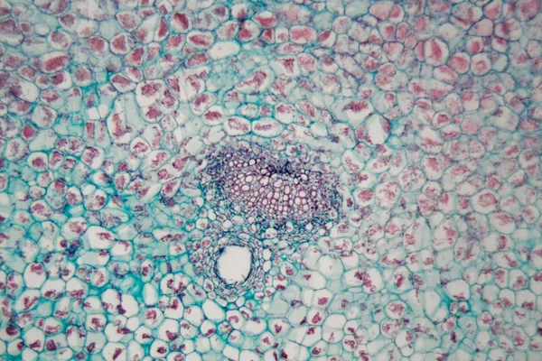 Células vegetais com danos causados por um animal parasita ao microscópio — Fotografia de Stock