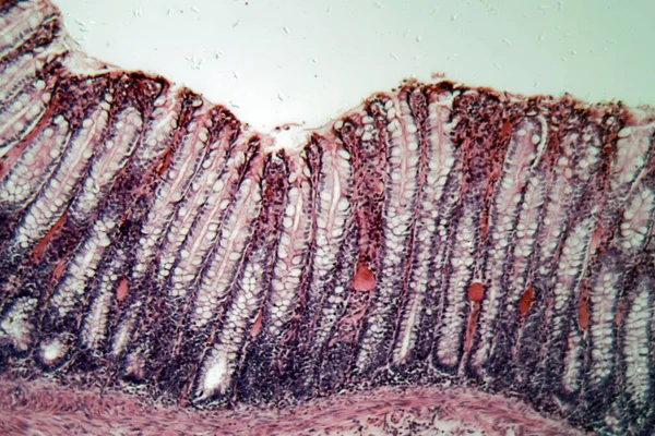 Microscope photo of a section through rectum cells of a dog.