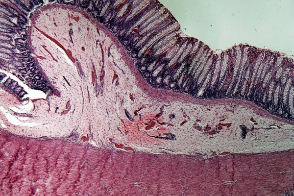 Microscope photo of a section through rectum cells of a dog.