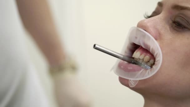 Mulher doente no dentista — Vídeo de Stock