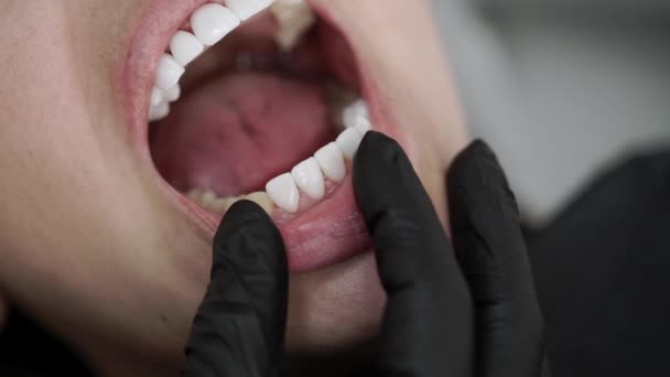 Paciente En clínica dental — Vídeo de stock